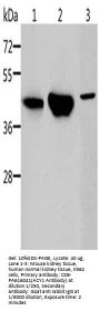 ACY1 Antibody