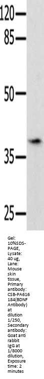 BDNF Antibody