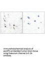 KCNC2 Antibody