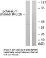 KCNC2 Antibody