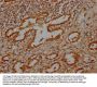 MBTPS1 Antibody