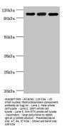 EFTUD2 Antibody