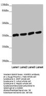ANKRD1 Antibody