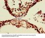 ZRSR2 Antibody