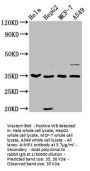 AIMP1 Antibody