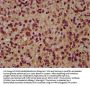 AIMP1 Antibody