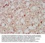 AIMP1 Antibody