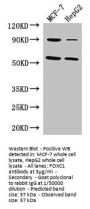 FOXC1 Antibody