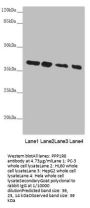 PPP1R8 Antibody