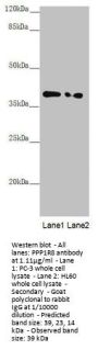 PPP1R8 Antibody