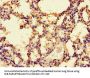 PRKAA1 Antibody