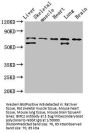 BIRC2 Antibody