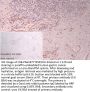 BIRC2 Antibody