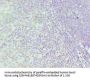 HNRNPD Antibody
