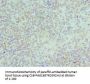 HNRNPD Antibody