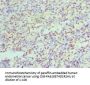HNRNPD Antibody