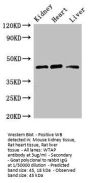 WTAP Antibody