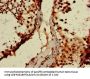 WTAP Antibody