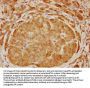 ARHGEF6 Antibody