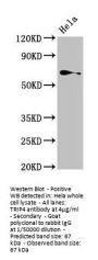 TRIP4 Antibody