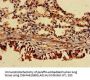 TRIP4 Antibody