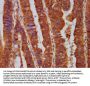 PPP2R5E Antibody