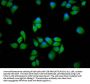 PPP2R5E Antibody