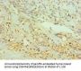 NTRK2 Antibody
