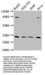DUSP4 Antibody