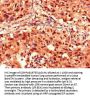 PSMD2 Antibody