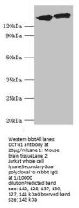 DCTN1 Antibody