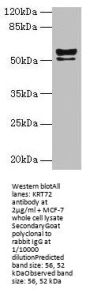 KRT72 Antibody