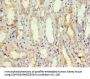 Rabbit anti-human Periostin polyclonal Antibody(POSTN)