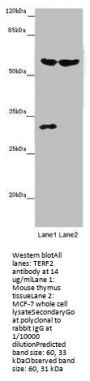 TERF2 Antibody