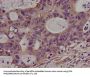PKN2 Antibody