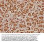 HIST2H2BE Antibody