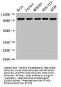 DDR2 Antibody