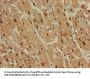 DDR2 Antibody