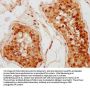 LY6K Antibody