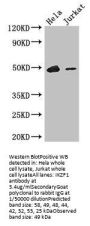 IKZF1 Antibody