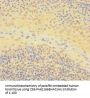 IKZF1 Antibody