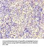 IKZF1 Antibody