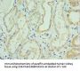 SLC39A6 Antibody