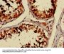 TUBA3C Antibody