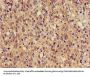 TUBA3C Antibody