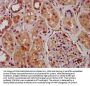 SUZ12 Antibody