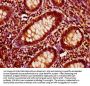 ITSN1 Antibody