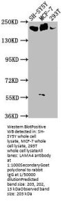 LAMA4 Antibody