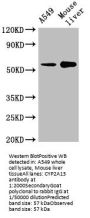 CYP2A13 Antibody