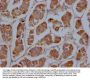 CYP2A13 Antibody